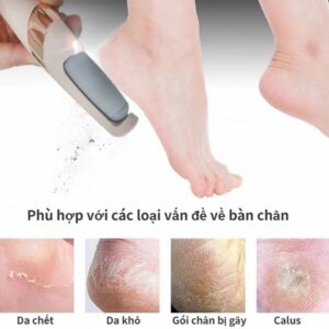 {Cao Cấp} Máy Chà Gót Chân 2 Đầu Mài Tẩy Tế Bào Chết, Thiết Kế Nhỏ Gọn, Sạc Pin Tiện Lợi, Chăm Sóc Gót Chân Tại Nhà Hiệu Quả, Được Nhiều Khách Hàng Lựa Chọn, Xuất Xứ Nhật Bản, Mẫu Mới 2026. 10 may cha got chan 1