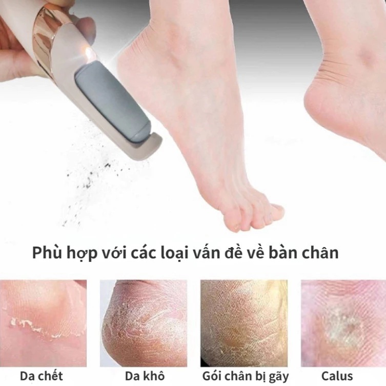{Cao Cấp} Máy Chà Gót Chân 2 Đầu Mài Tẩy Tế Bào Chết, Thiết Kế Nhỏ Gọn, Sạc Pin Tiện Lợi, Chăm Sóc Gót Chân Tại Nhà Hiệu Quả, Được Nhiều Khách Hàng Lựa Chọn, Xuất Xứ Nhật Bản, Mẫu Mới 2026. 15 may cha got chan 1