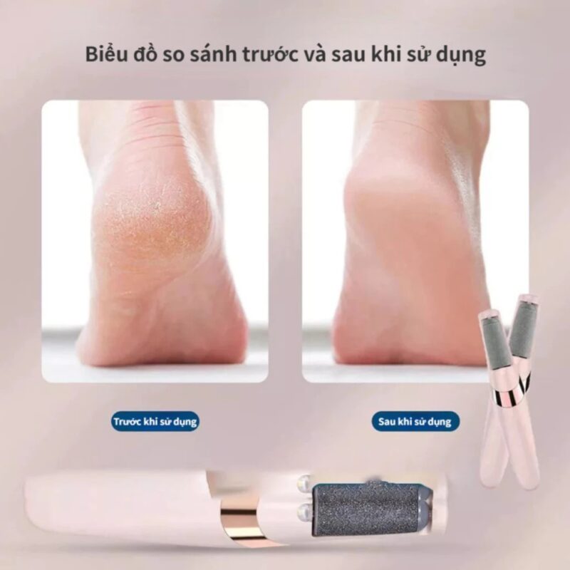 {Cao Cấp} Máy Chà Gót Chân 2 Đầu Mài Tẩy Tế Bào Chết, Thiết Kế Nhỏ Gọn, Sạc Pin Tiện Lợi, Chăm Sóc Gót Chân Tại Nhà Hiệu Quả, Được Nhiều Khách Hàng Lựa Chọn, Xuất Xứ Nhật Bản, Mẫu Mới 2026. 18 may cha got chan 3